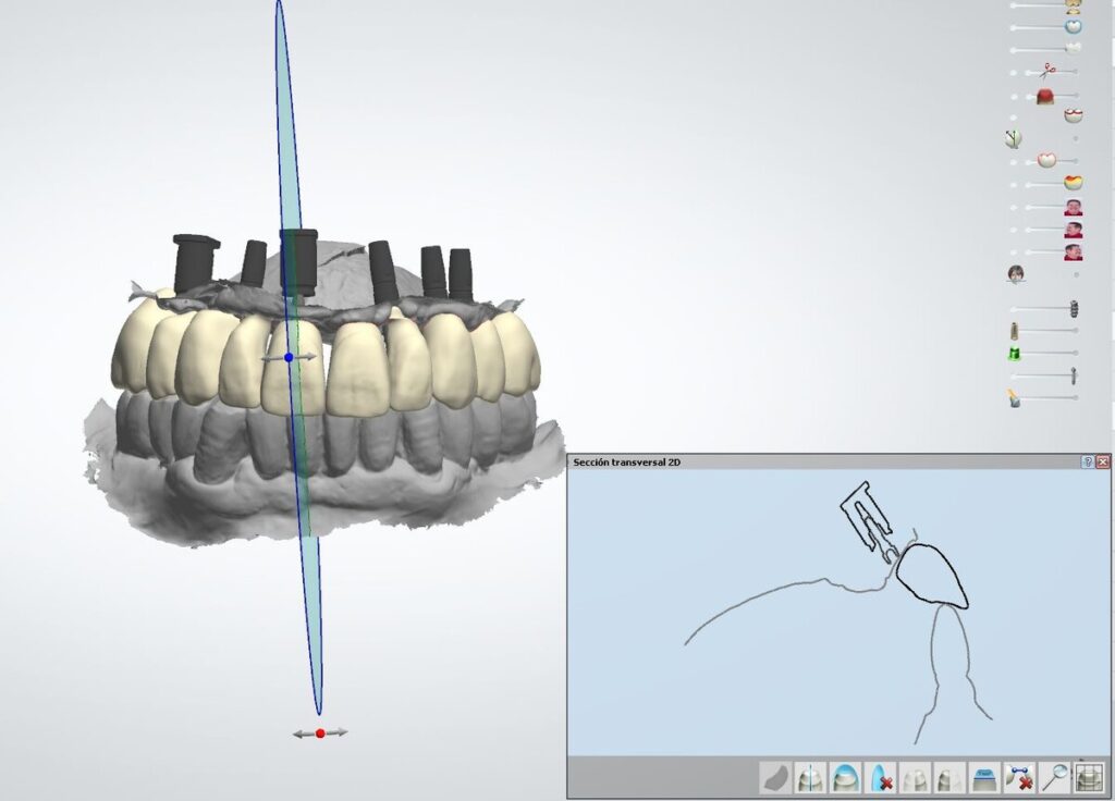 DISEÑO CAD